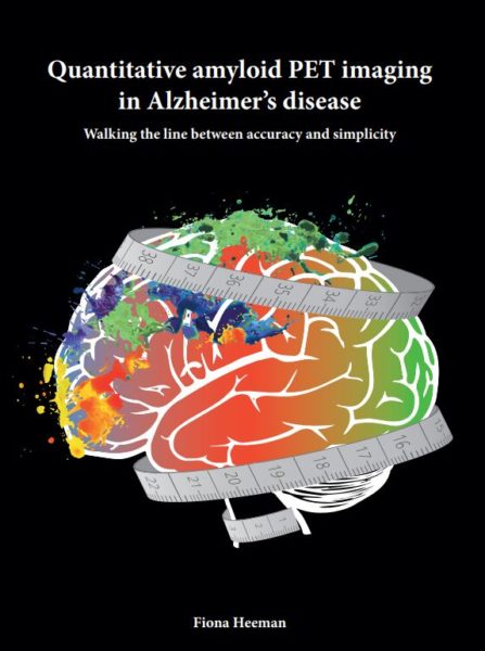 thesis about alzheimers disease