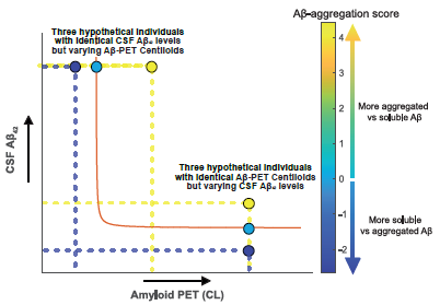 A continuous amyloid-beta CSF/PET imbalance model to capture Alzheimer's disease heterogeneity