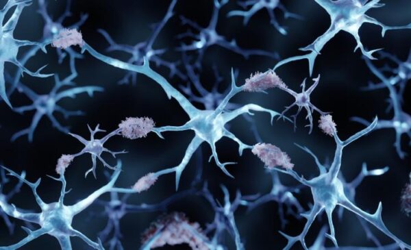 EMA endorses Centiloid method for the measurement of brain amyloid burden